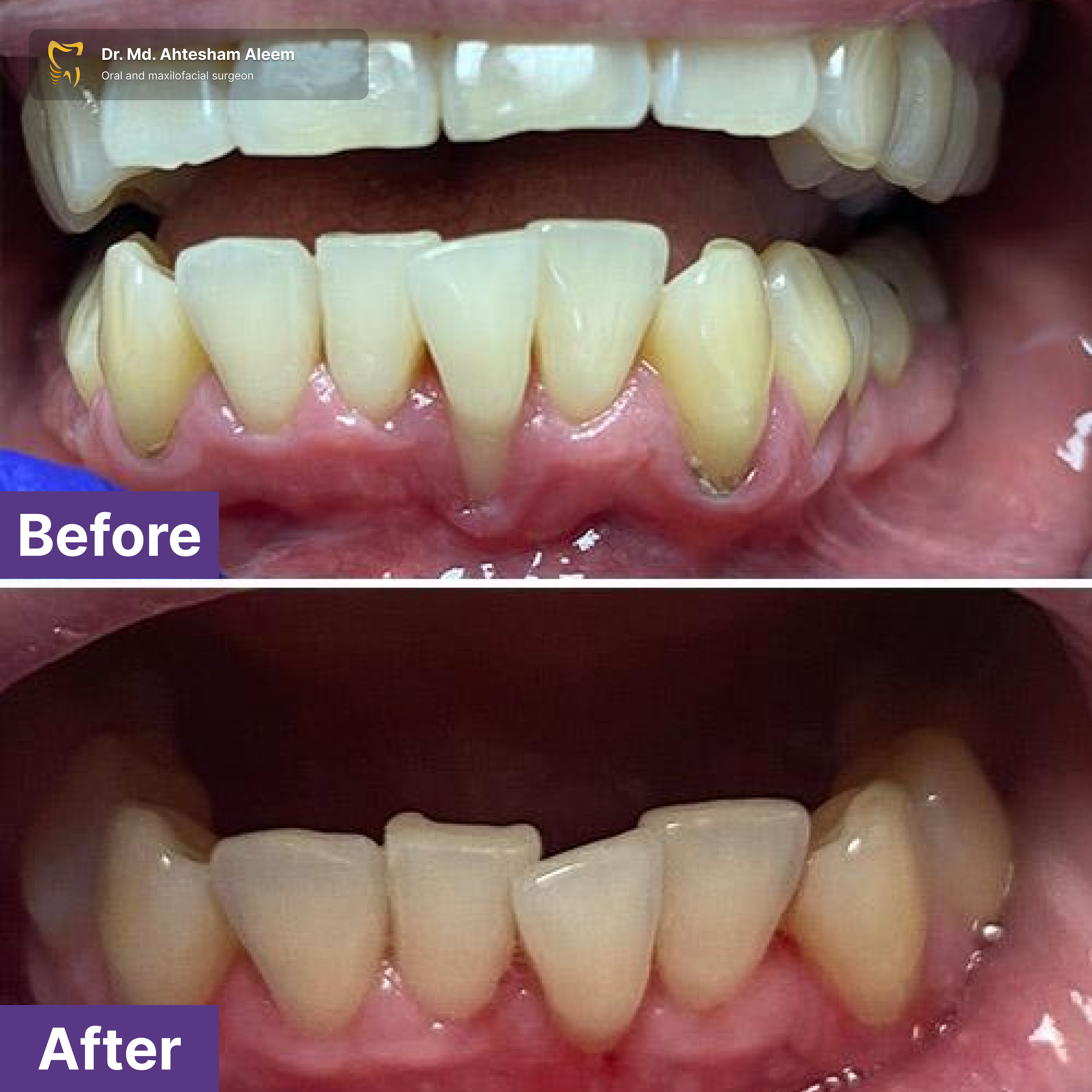 Advanced Laser Dentistry Gallery 4